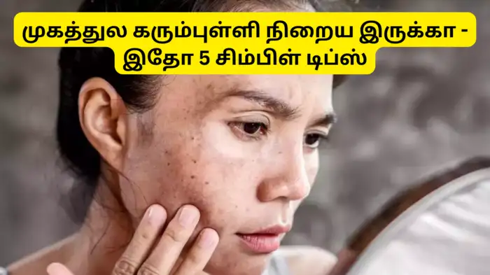 முகத்துல கரும்புள்ளிகள் நிறைய இருக்கா?
